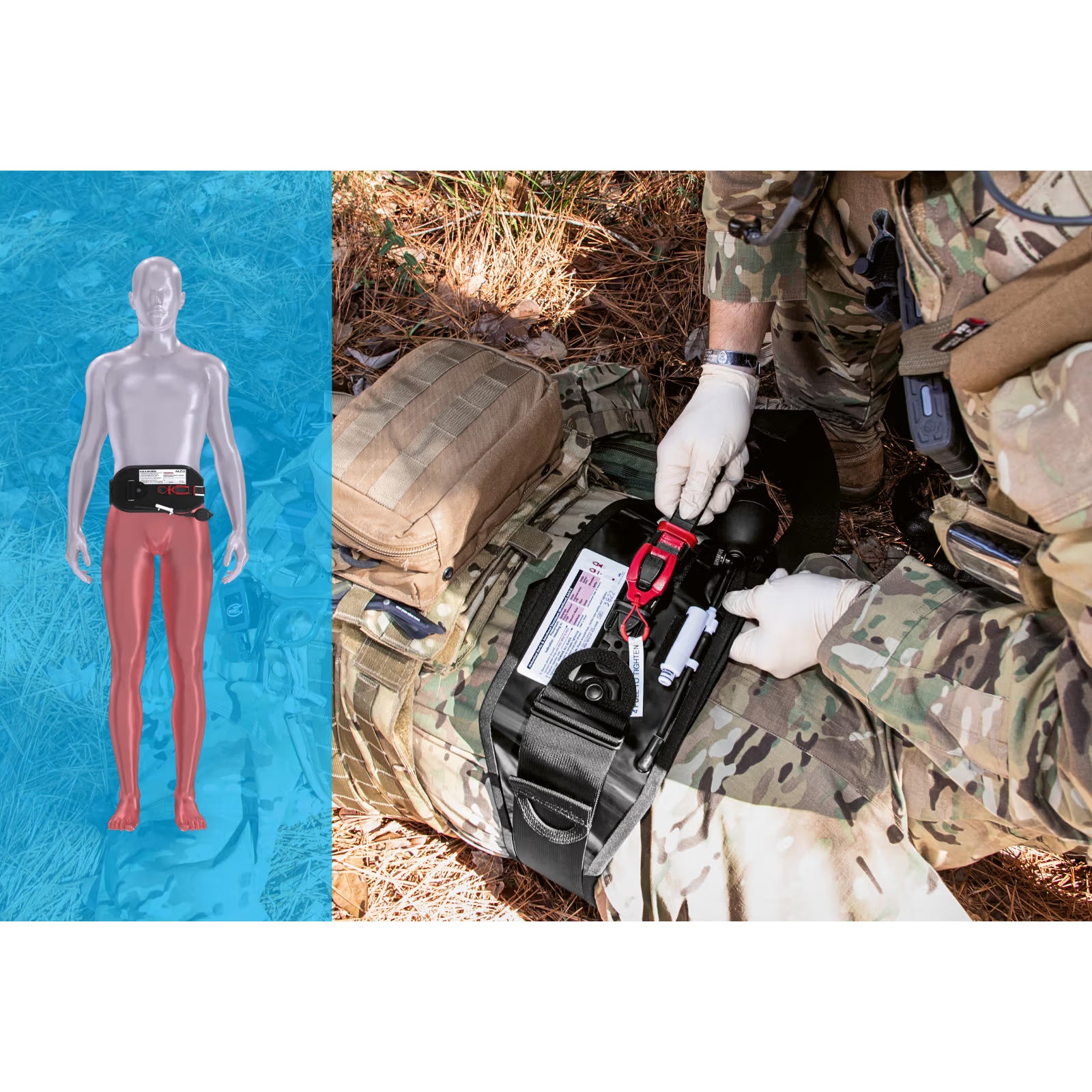 Abdominal Aortic & Junctional Tourniquet-Stabilized (AAJT-S)