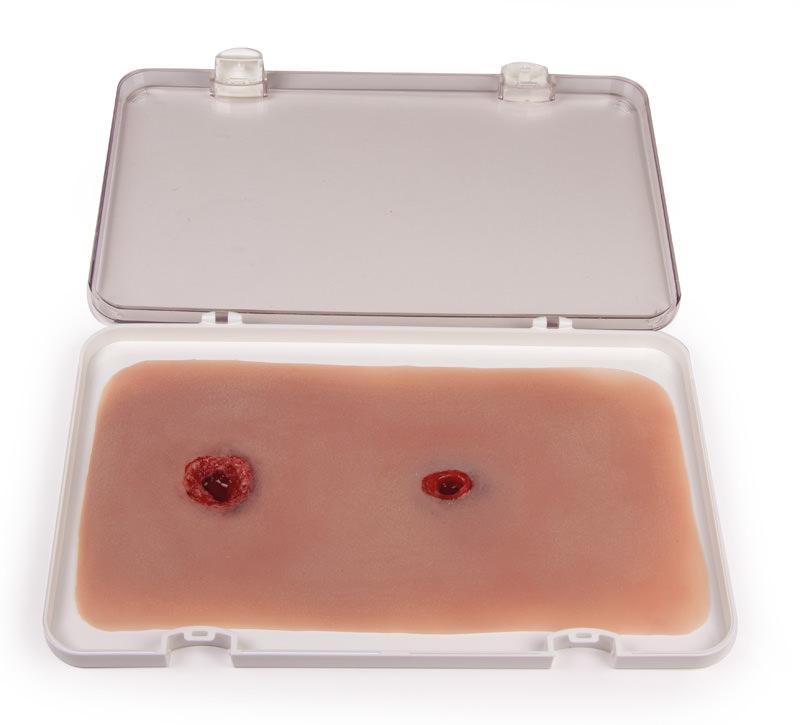 Erler - Zimmer Woundmoulage Schusswunde Arm mit Blutungsfunktion - Critical Knowledge