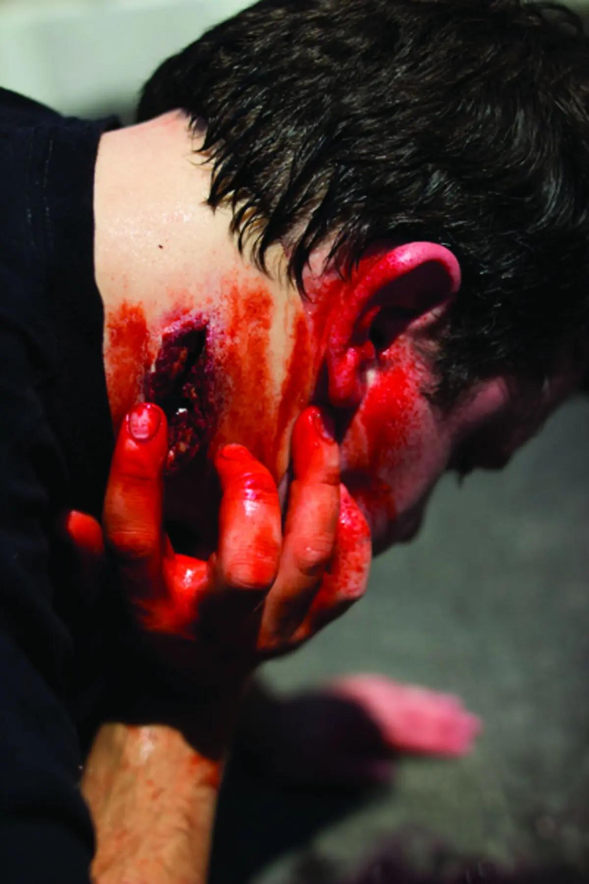 Techline Moulage Nacken Wunde - Critical Knowledge