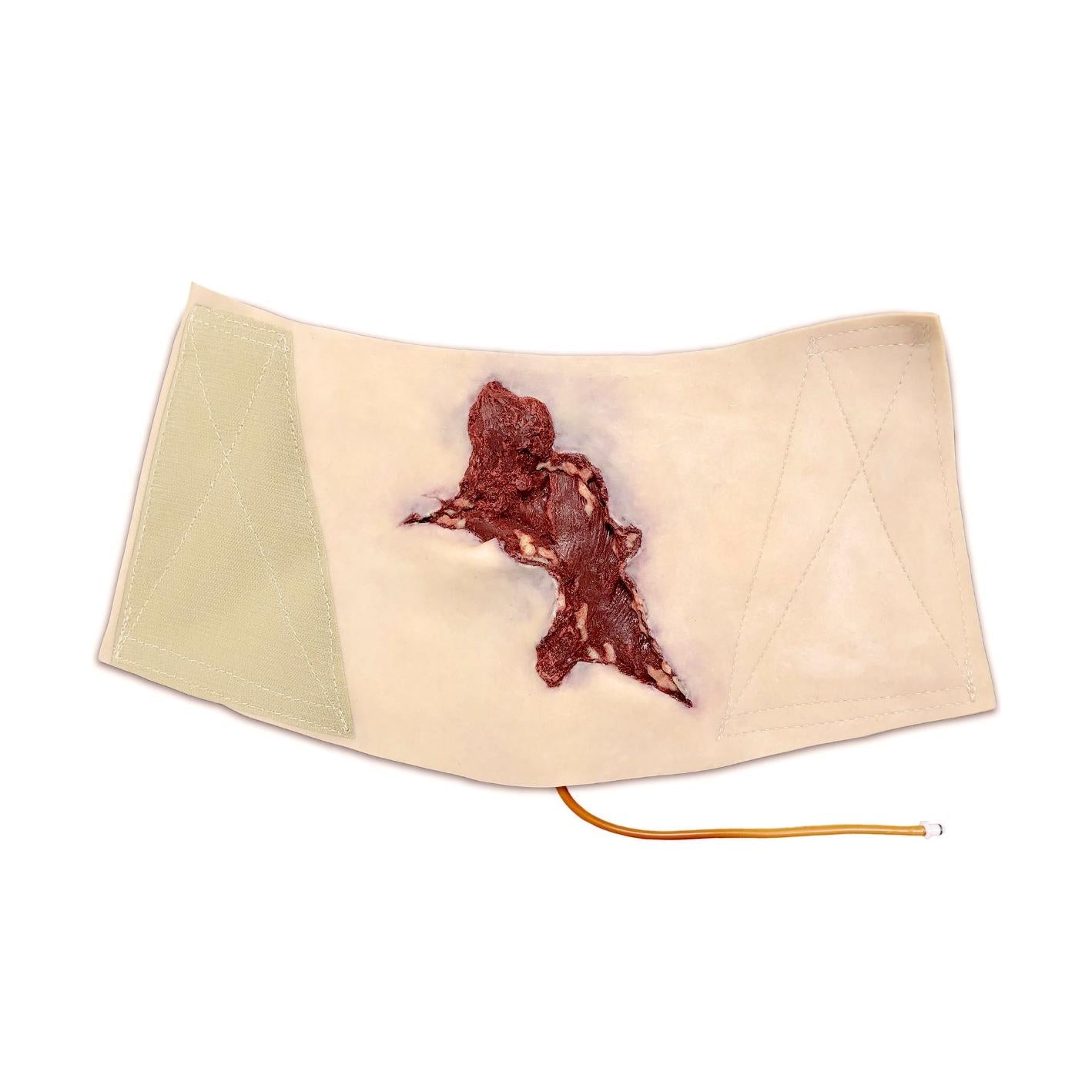 Techline Moulage Offene Wadenverletzung - Critical Knowledge