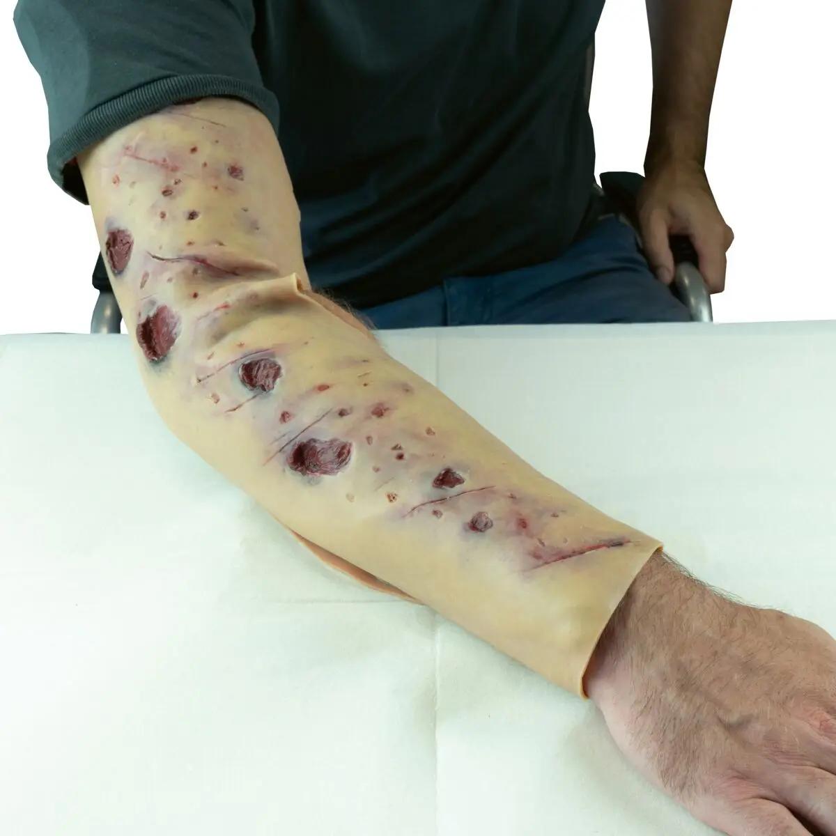 Techline Moulage Schrapnelverletzung Kompletterarm (rechts) - Critical Knowledge