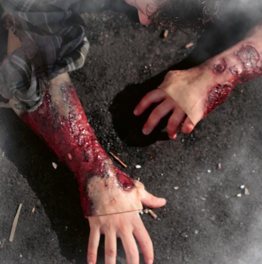 Techline Moulage Schwere Verbrennung - Unterarm (links) - Critical Knowledge