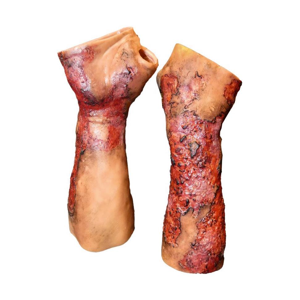Techline Moulage Schwere Verbrennung - Unterarm (rechts) - Critical Knowledge