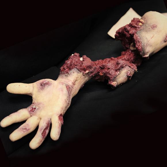 Techline Moulage Teilamputation Arm mit hartem Knochen (rechts) - Critical Knowledge