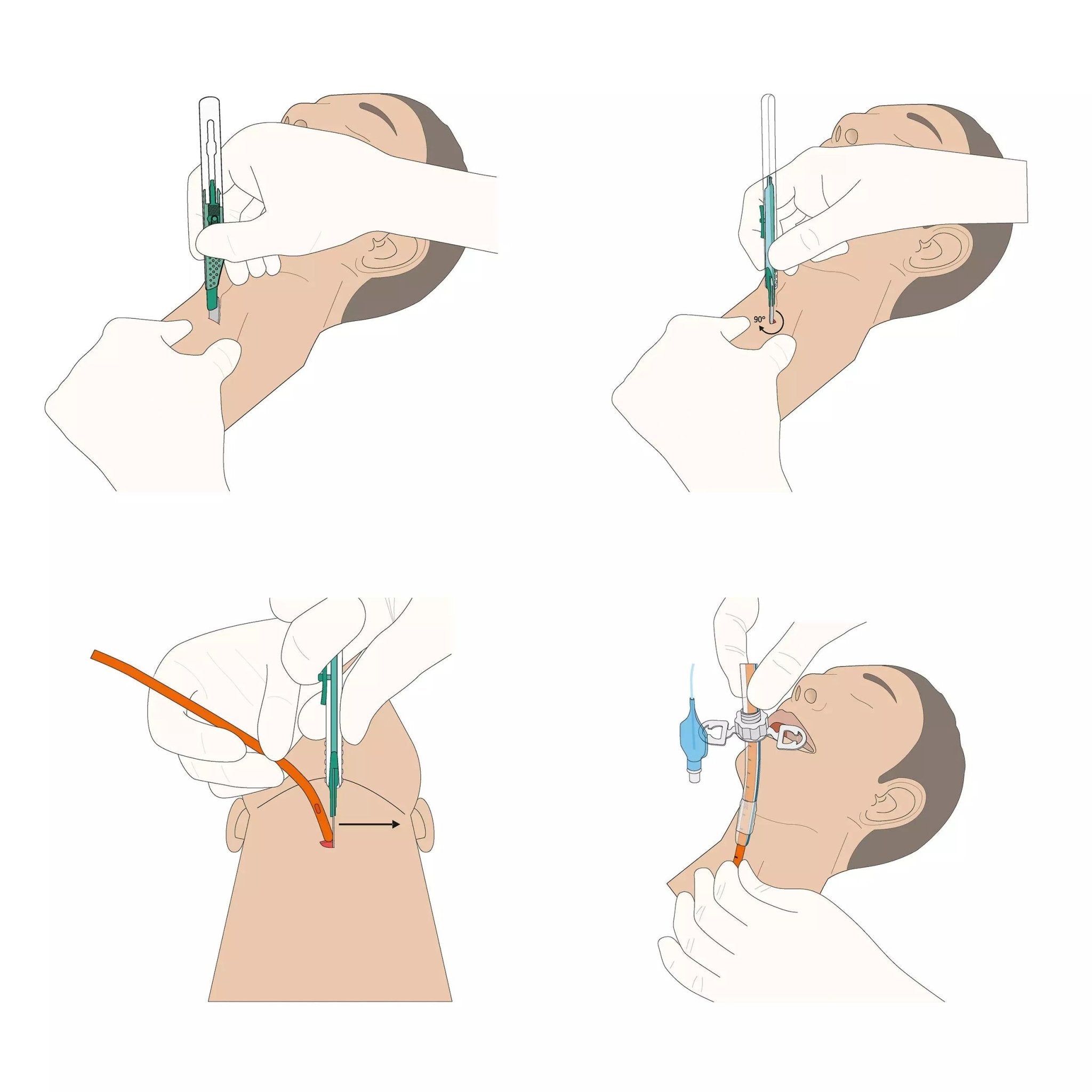 VBM ScalpelCric – Chirurgisches Koniotomie - Set - Critical Knowledge